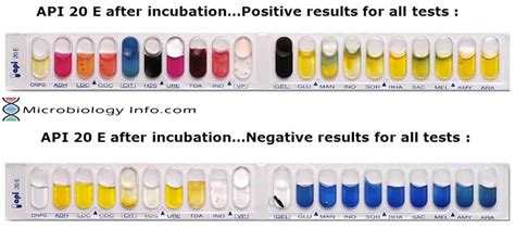 analytical profile index|API 20E Test System: Results and Interpretations .